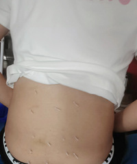 ȥ��ҽԺN�ζ�û�κõ���ʹ�����������ҽ��һ�궼ûʹ����