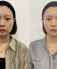 ֻ��һ��Ǯ�������˳�����ȫģʽ�����ܺ�����ı�Сһ��Ȧ