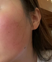 �гɹ��޸���Ƥ����������Ľ����𣿶�����˵˵���÷���