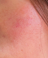 õ���3�꣡�������ڻָ����˽��������Ƽ��ҵķ���