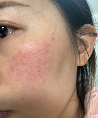 õ���3�꣡�������ڻָ����˽��������Ƽ��ҵķ���