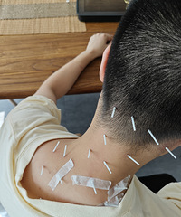 �羱����ֻҪһСʱ��������ܻ��⽩Ӳ��ʹ��������ҽ������