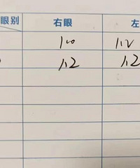 记录全飞秒近视手术亲身经历,给你参考意见