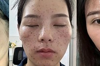 祛斑还是要直接,我就是被这些淡斑产品耽误了