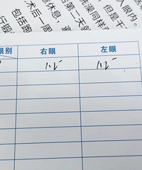 找到做ICL晶体植入的权威医生,术后1.2