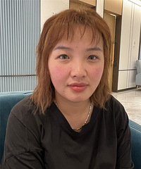易可美微针,居然连我这种过敏泛红脸都能修复
