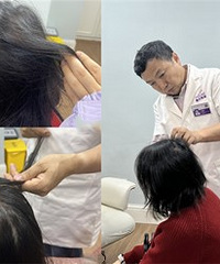 皮肤科专家刁庆春,也要看脱发问题