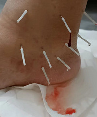 �ؽ�������ʹ�ü����ˣ����𴲶����ѵ��ң����������κ���