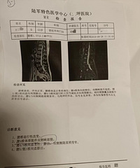 腰椎滑脱真的快痛死我了!做了2个疗程空心针治疗,现在生活如常