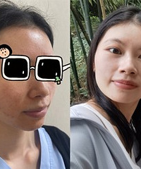 看了皮肤科医生后,我素颜变这样