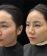 "��ܽ��+�ƽ�����"����˥��Ŀǿǿ���ϣ���һ����ʲô�ı�