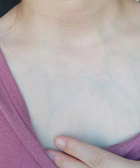 ĸ�������£���ǰѪ�����Ե����Ǳ��죬���ˣ�