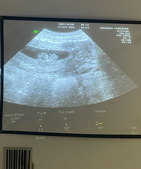 �����ھͿ�ʼ©��Ľ��ã�����һ̥���Ƕ�̥ѽ