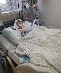 13岁男孩被同学打进ICU,抢救难度极大