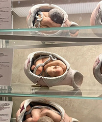 �����չ������������λ������η��䡢����̥��