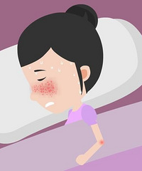 你们身边有红斑狼疮患者吗?