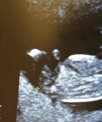 ���������Թ�ʧ�ܺ���Ȼ���У���ӵ�����ҵ�С�Ի�