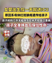 ŮӤ������һ��ͽ�ICU ��ԭ��ϵĸ�����Ǵ��Ŵ����˺���