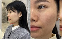 能够提升面部肌肉的抗衰神器+小黑瓶水光!
