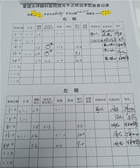 做完近视手术,现在双眼视力1.2!个性化飞秒恢复得真快