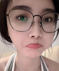 做完ICL近视手术依然能戴美瞳,这个三甲医院出来的院长很靠谱
