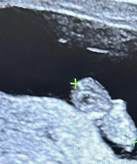 ��ǻ������������У���ǰ��黹û���꣬��������������