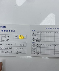 这种全程无接触和无切口的近视手术,做完后视力恢复得超好