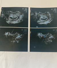 ����Ѫ���㣬������ҽ�����˰��꣬������������