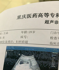 ������ȥ��ɫӡ��ϴ����