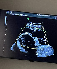 ������ʿҽԺB��Ч���𾪵��ˣ�̫�����ˣ�