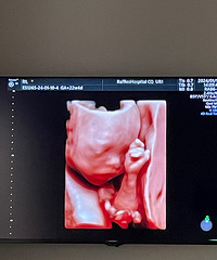 ������ʿҽԺB��Ч���𾪵��ˣ�̫�����ˣ�