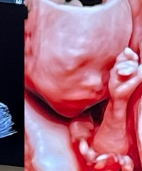 ������ʿҽԺ�ĳ���B��Ч���𾪵��ˣ�̫�����˰�