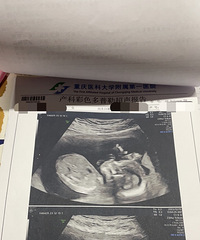 �Ӻ���ѽ�����������ˡ����б�ϲ��