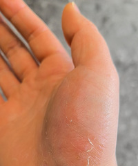 ���Ƴ��곤Сˮ�ݾ����ޱȣ����Ƽ�ҩƷ����ҽ��
