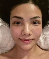 推荐这个才100多的皮肤管理!做完眼睛不肿了,还淡化了黑眼圈
