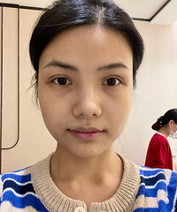 推荐这个才100多的皮肤管理!做完眼睛不肿了,还淡化了黑眼圈