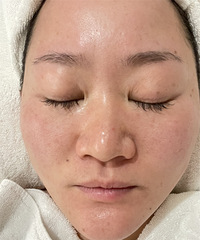 过年前要好好保养皮肤,188做到了思妍丽面部SPA,好划算