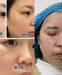 ����Ƥ�뵭��7����Ч������������