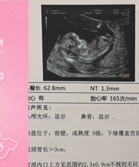 ���û�С���ȫ�ڡ����¾����һ��ͬ����Ȼ������