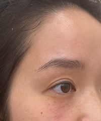 淡化黑眼圈用这个方法是真明显!过年前搞一次