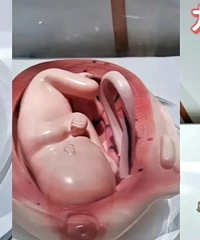 ��ֱ�۵�̥����������