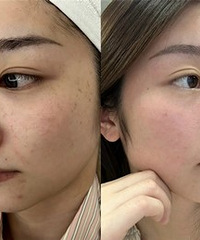 ��Ƥ��������ܶԸ�ȸ�ߣ����ſ���