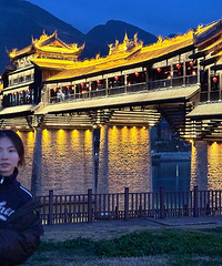 做完近视手术半年,说说真实感受!视力比戴眼镜时还好