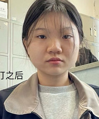 短方脸亲测!这个瘦脸方法真的有效,8天就变化一目了然