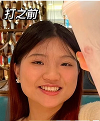 短方脸亲测!这个瘦脸方法真的有效,8天就变化一目了然