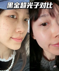 �����ǿ�������ڽ𳬹���10����Ƥ���仯��Ч����ĺ�ţ