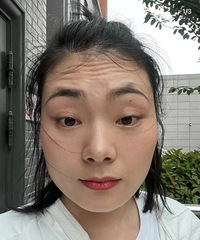 快看!我的抬头纹真的没有了,这个方法真的又快又实用