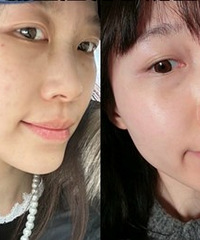 ���ڽ𳬹���10���ı仯