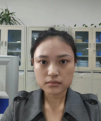第一次用这种方式瘦脸很满意,2个月后效果最佳
