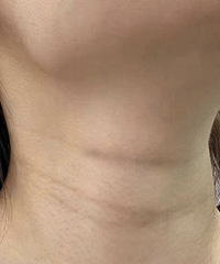 �����ͷ���ֻ���������ĺ����أ���������������Ч��̫����